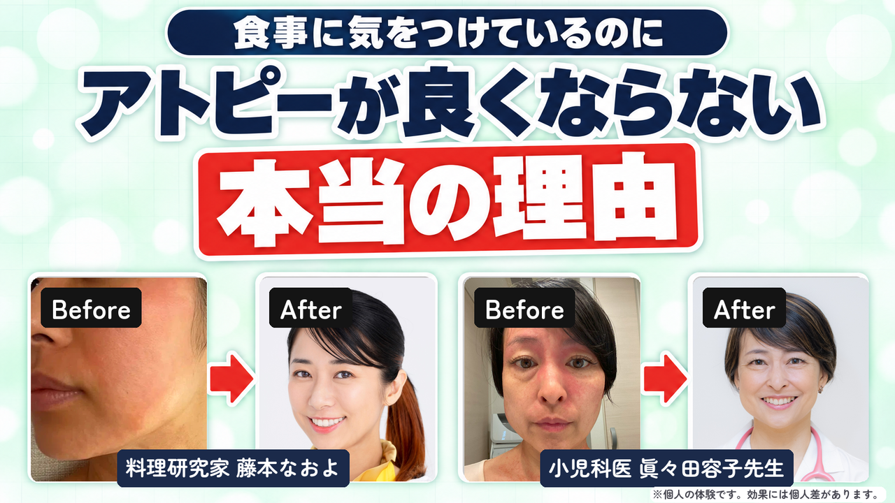 サムネイル：食事に気をつけているのにアトピーが良くならない本当の理由